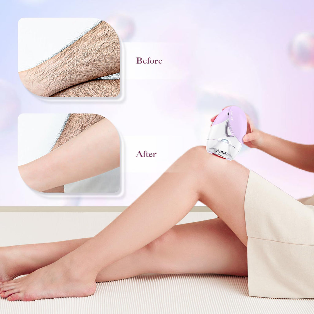 2-Speed Adjustable Epilator with 36 Tweezers C913